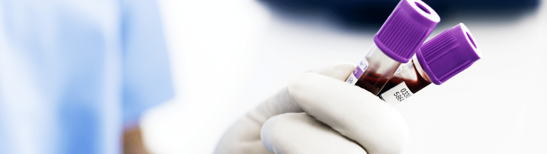 Immunoassay testing Radiometer